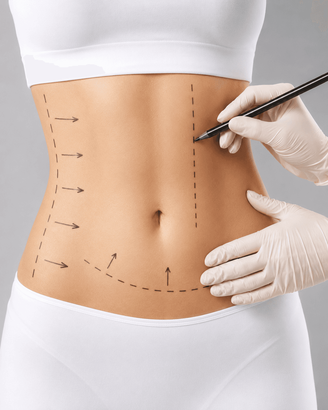Patient consultation for body contouring and plastic surgery planning